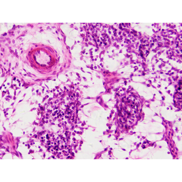 Bresser Permanenta preparat Histologi 30 stycken