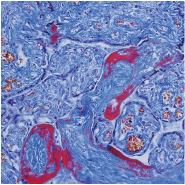 Evident Olympus Mikroskop CX41 Cytologi, halogen, trino 40x,100x, 400x