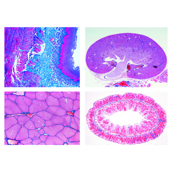 LIEDER Sekundär nivå II Metabolism (15 bilder)