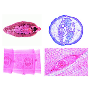 LIEDER Parasitology Large Series 50 Prep.