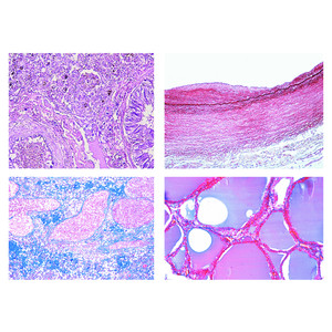 LIEDER Patologisk histologi hos människa, liten serie (50 bilder)