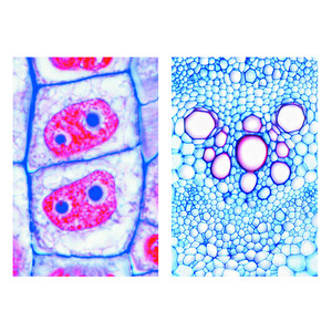 LIEDER Växtcell (cytologi), bas (6 preparat), elevuppsättning
