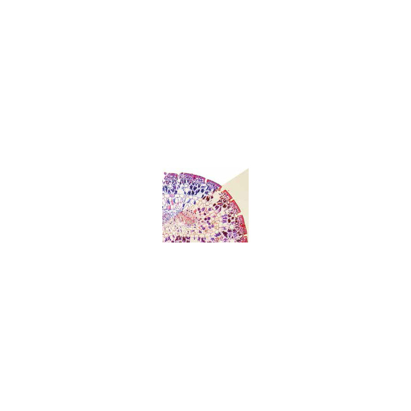 Optika Mikroskop B-382PHi-ALC, PH, bino, infinity, ALC, W-PLAN, 100x-1000x, 3W LED