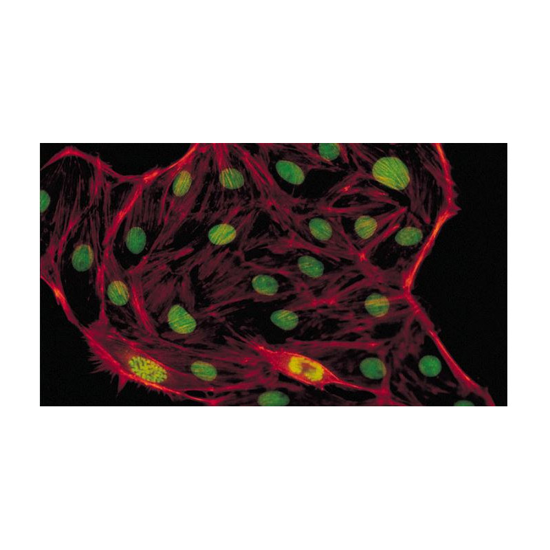 Evident Olympus Mikroskop CX41 Fluorescens, trino, Hal, 40x,100x, 400x