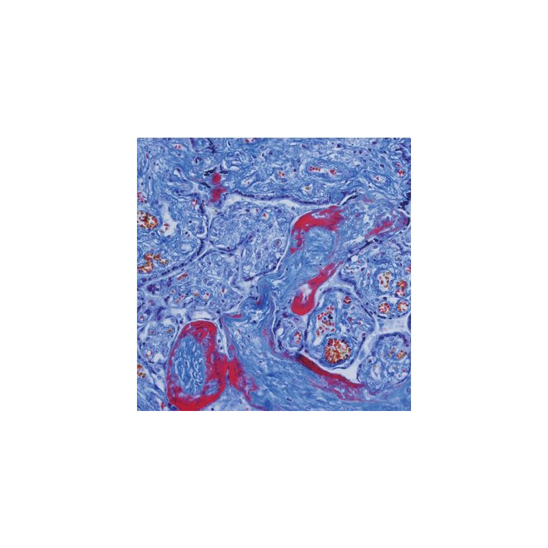 Evident Olympus Mikroskop CX41 Hematologi, bino, ergo, Hal, 40x, 500x, 1000x