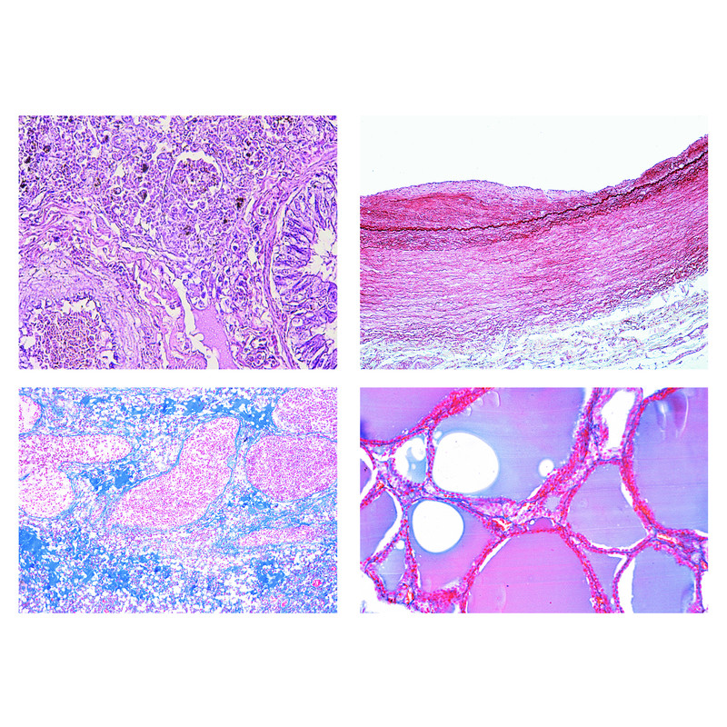 LIEDER Humanpatologisk histologi, liten serie (50 preparat)