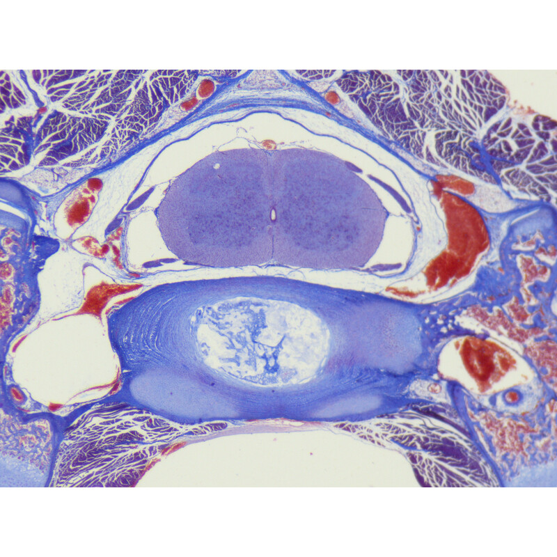 ZEISS Zoom-stereomikroskop Stemi 355, C Lab, trino, BF, DF, w.d. 110 mm, 10x/23, 5,5:1 , 7,2x-40x, AL/DL, Spot C LED